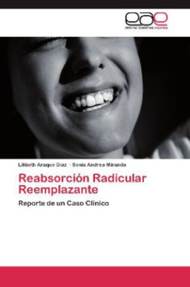 Reabsorción Radicular Reemplazante