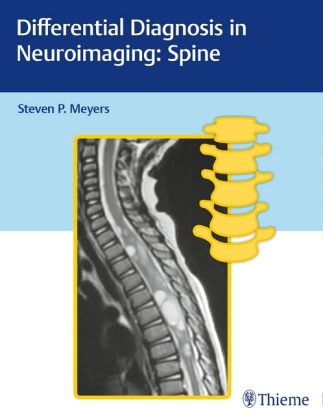 Differential Diagnosis in Neuroimaging - Spine