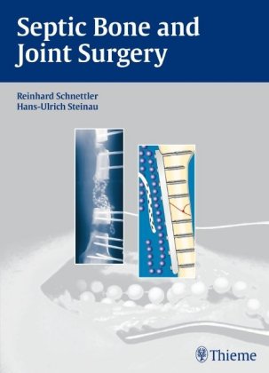 Septic Bone and Joint Surgery