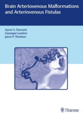 Brain Arteriovenous Malformations and Arteriovenous Fistulas