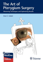 The Art of Pterygium Surgery