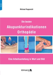 Die besten Akupunkturindikationen Orthopädie