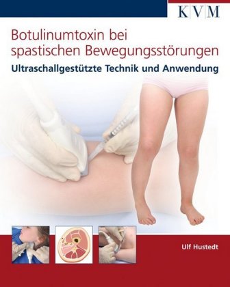 Botulinumtoxin bei spastischen Bewegungsstörungen